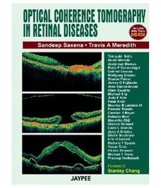 Optical Coherence Tomography In Retinal Diseases With Photo DVDRom