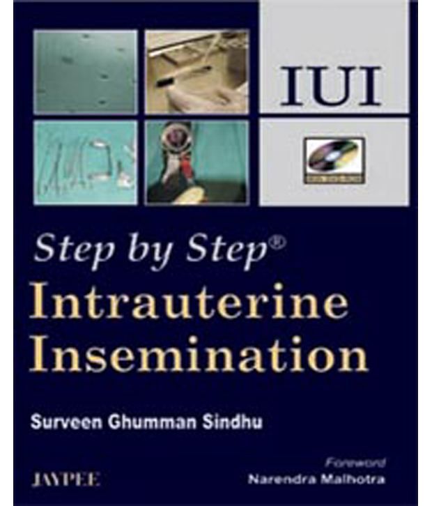 Step By Step Intrauterine Insemination (With Dvd-R: Buy Step By Step ...