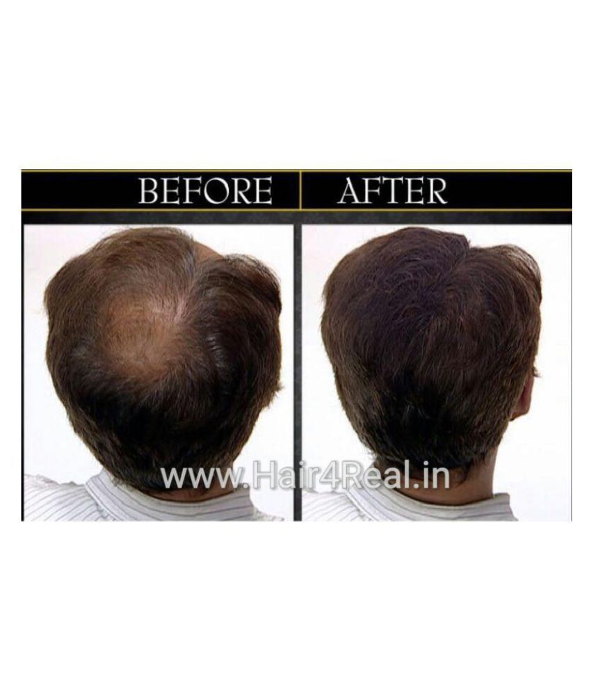 Hair4real Hair Thickening Fibers Black 12g Buy Hair4real Hair