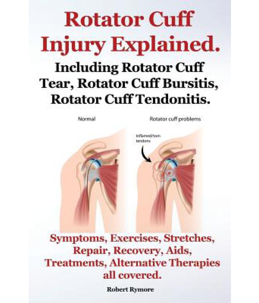 Rotator Cuff Injury Explained. Including Rotator Cuff Tear, Rotator ...