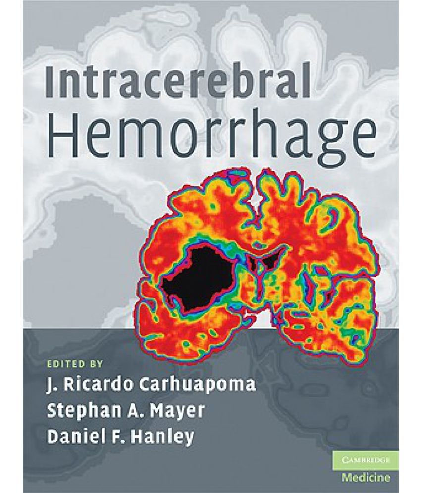 intracerebral-hemorrhage-buy-intracerebral-hemorrhage-online-at-low