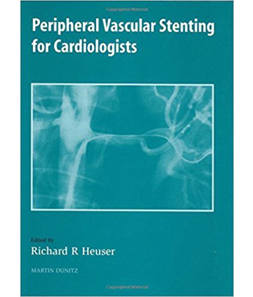 Peripheral Vascular Stenting For Cardiologists Buy Peripheral Vascular