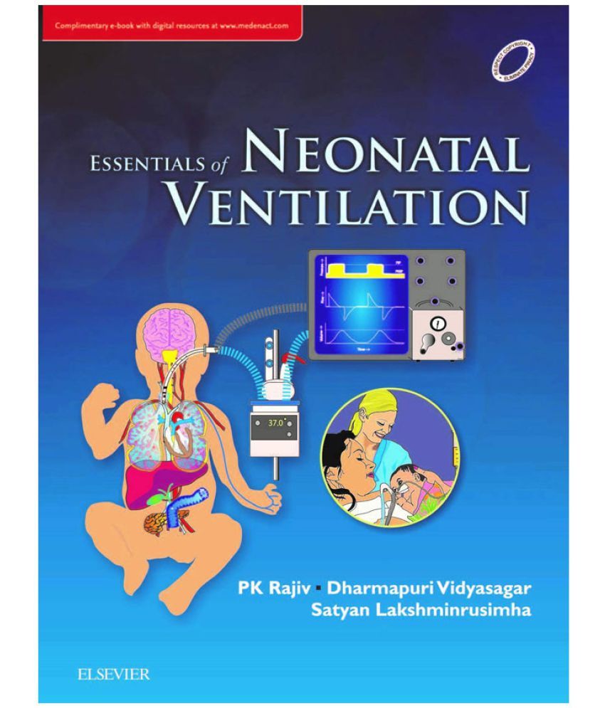 Essentials of Neonatal Ventilation: Buy Essentials of Neonatal