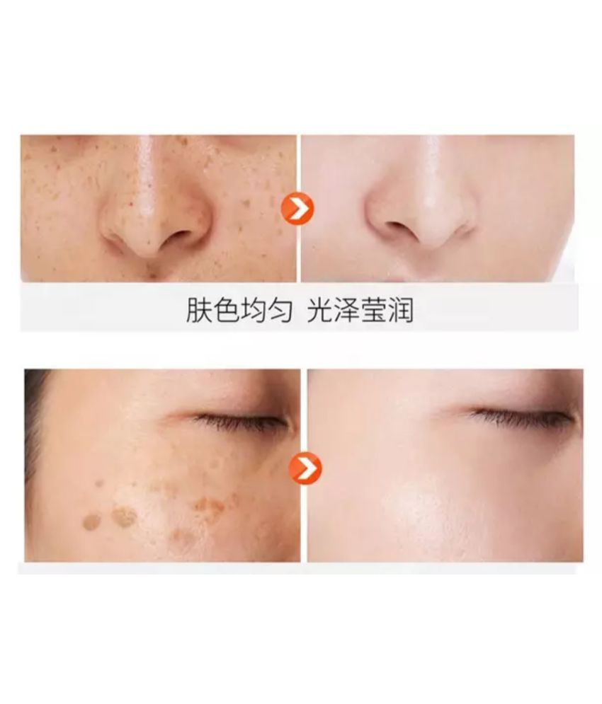 FAIRY BEAUTY ACNE & PIMPLES CONTROL CREAM Night Cream 30 gm Buy FAIRY