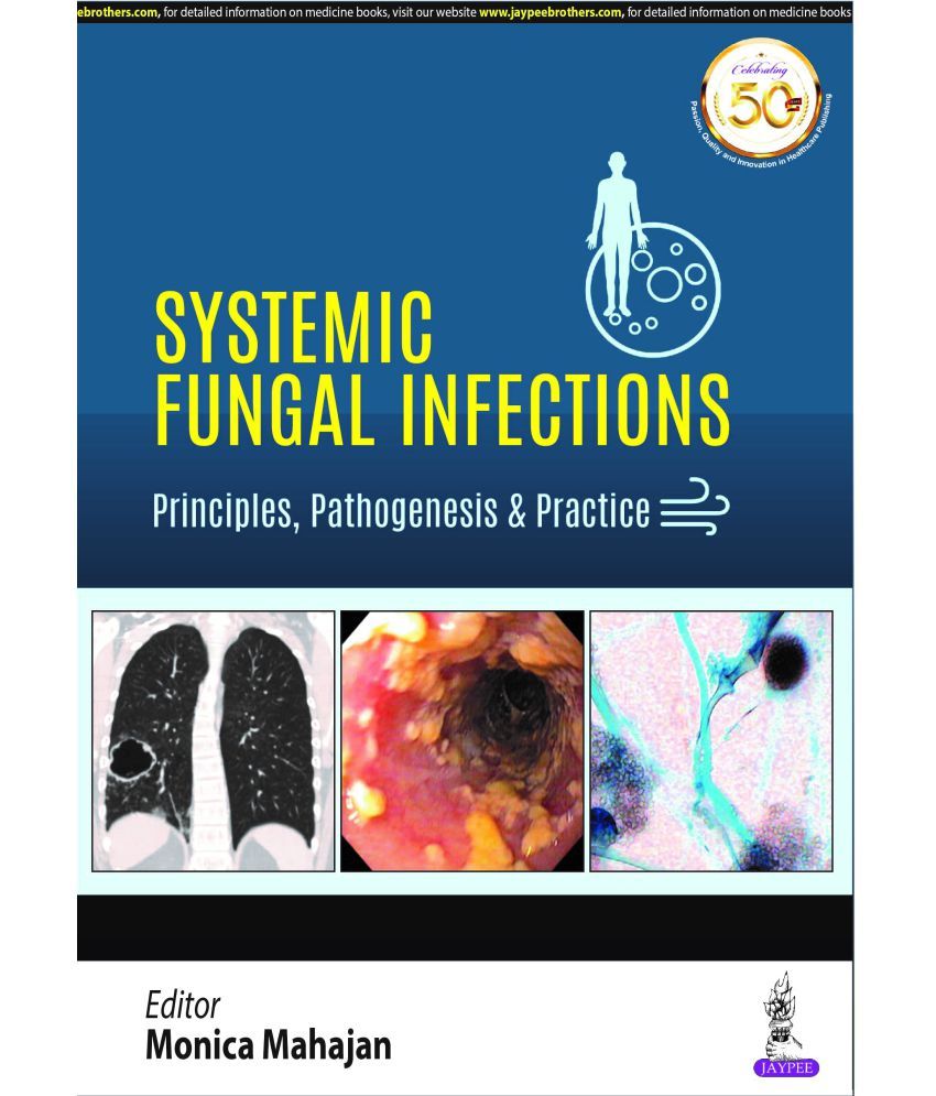 systemic-fungal-infections-principles-pathogenesis-practice-buy