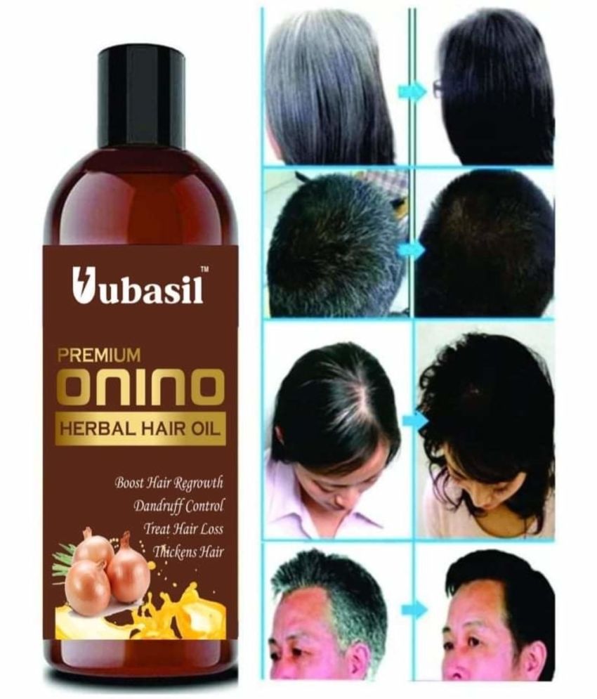 Uubasil Red Onion Hair Oil For Hair Growth & Hair Fall 100 mL Fliptop Plastic Jar