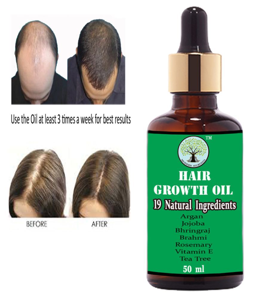 Modern Ayurveda Ayurvedic Hair Fall Treatment Oil Hair Growth Oil 50 Ml