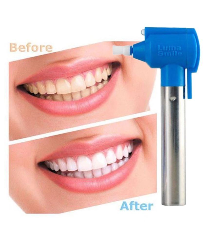 GSN Teeth Whitening Kit gm: Buy GSN Teeth Whitening Kit gm ...