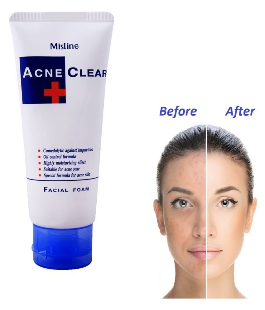 Mistine Acne Clear Facial Foam Multipurpose Gentle Skin Care Face Wash 85 Ml Buy Mistine Acne 