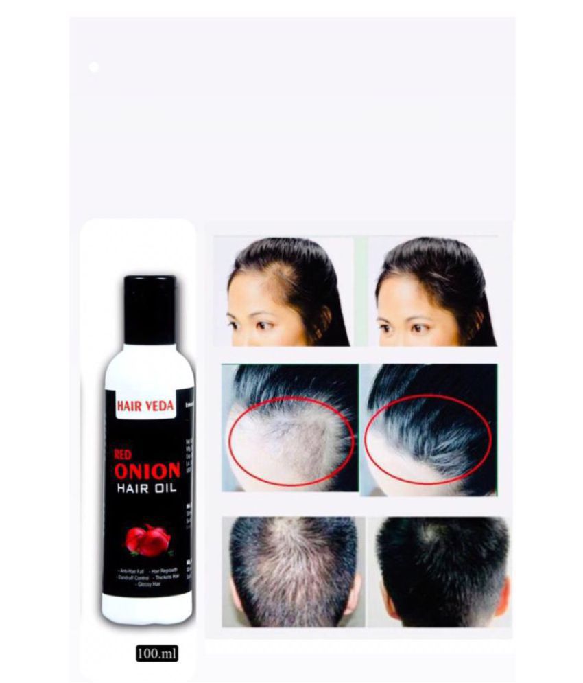 Hair Veda Red Onion Oil For Hair Fall & Growth Hair Oil 100 mL: Buy Hair  Veda Red Onion Oil For Hair Fall & Growth Hair Oil 100 mL at Best Prices
