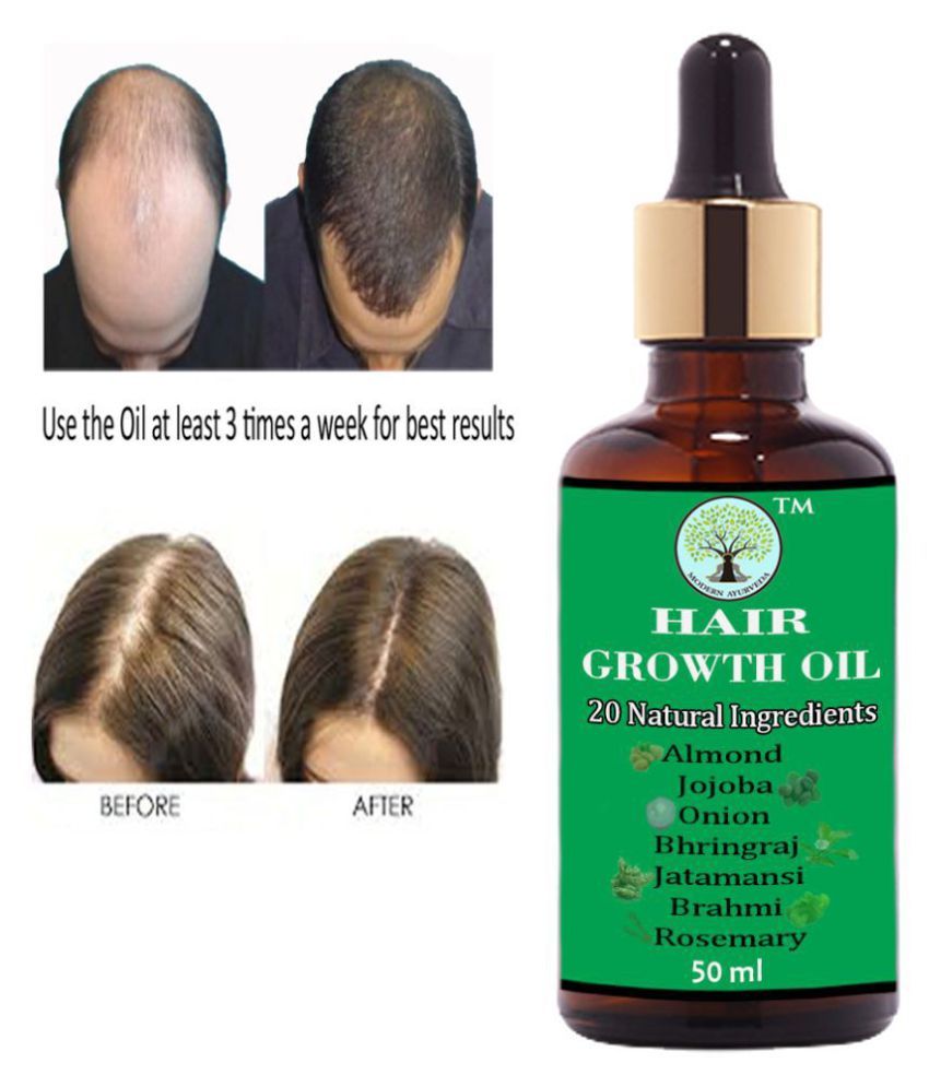 MODERN AYURVEDA Ayurvedic - Hair Fall Treatment Oil - Hair Growth Oil ...