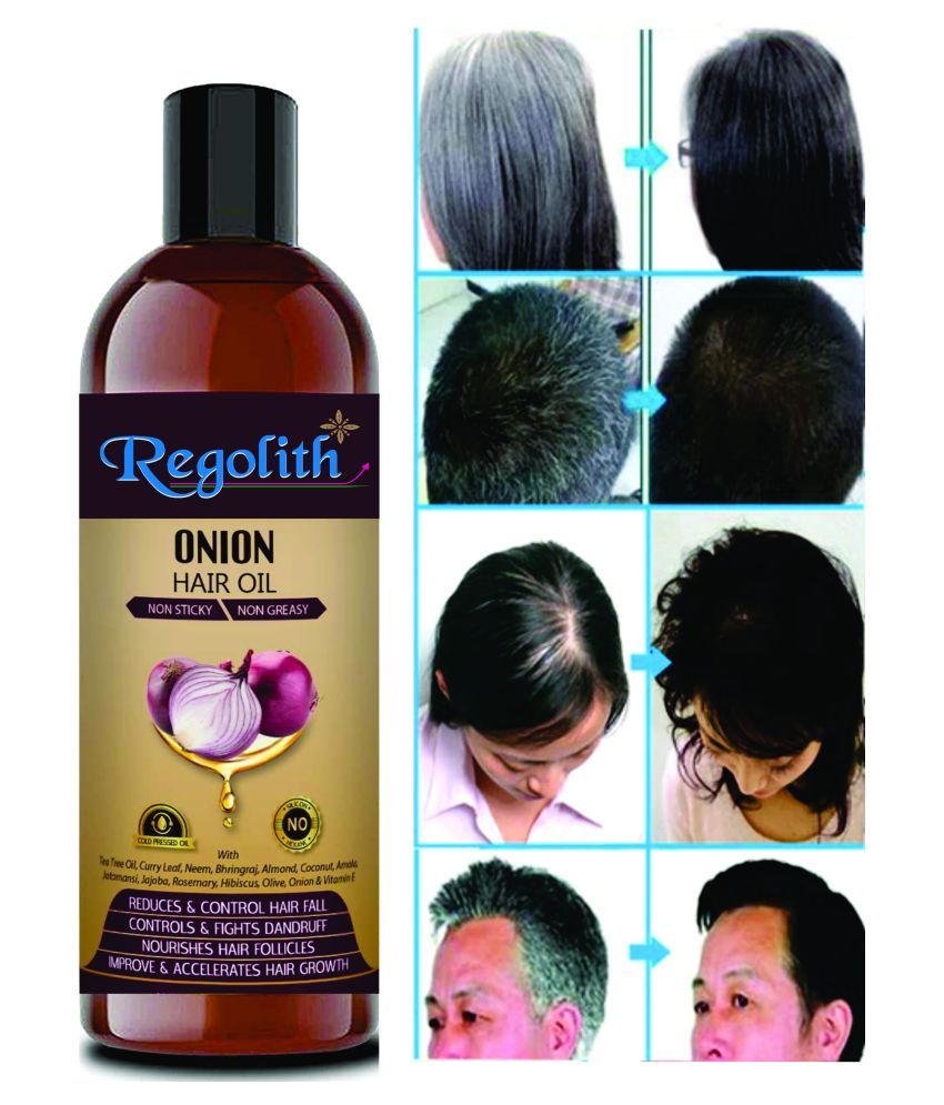 Regolith Onion Hair Oil Blend Of 14 Natural For Hair Growth 100 Ml Buy Regolith Onion Hair Oil Blend Of 14 Natural For Hair Growth 100 Ml At Best Prices In India Snapdeal