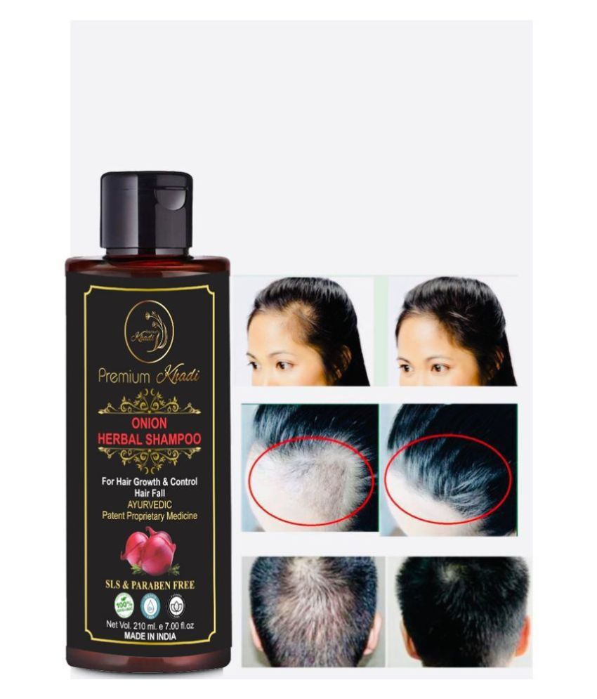     			Premium Khadi Onion Shampoo For Hair Growth With Aloevera, Argan oil SLS & Paraben Free Shampoo 210 mL