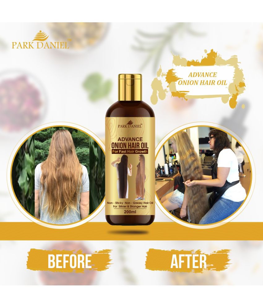     			Park Daniel Advance Onion Hair Oil-For Hair Growth & Reduces Hairfall 200 mL