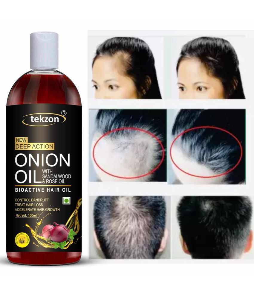 TEKZON - Anti Hair Fall Onion Oil 100 ml ( Pack of 1 ): Buy TEKZON - Anti Hair  Fall Onion Oil 100 ml ( Pack of 1 ) at Best Prices in India - Snapdeal