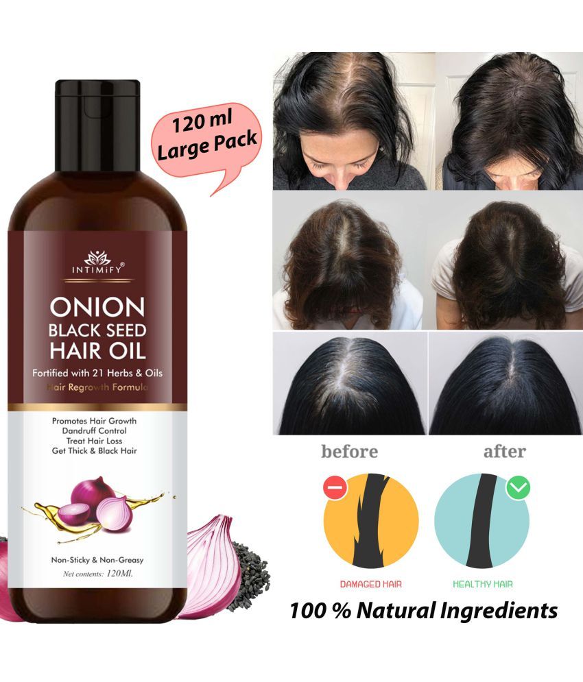 Intimify Onion Hair Oil to Promote Hair growth 120 mL: Buy Intimify Onion Hair Oil to Promote Hair growth 120 mL at Best Prices in India - Snapdeal Intimify Onion Hair Oil to Promote Hair growth 120 mL: Buy Intimify Onion Hair Oil to Promote Hair growth 120 mL at Best Prices in India - Snapdeal