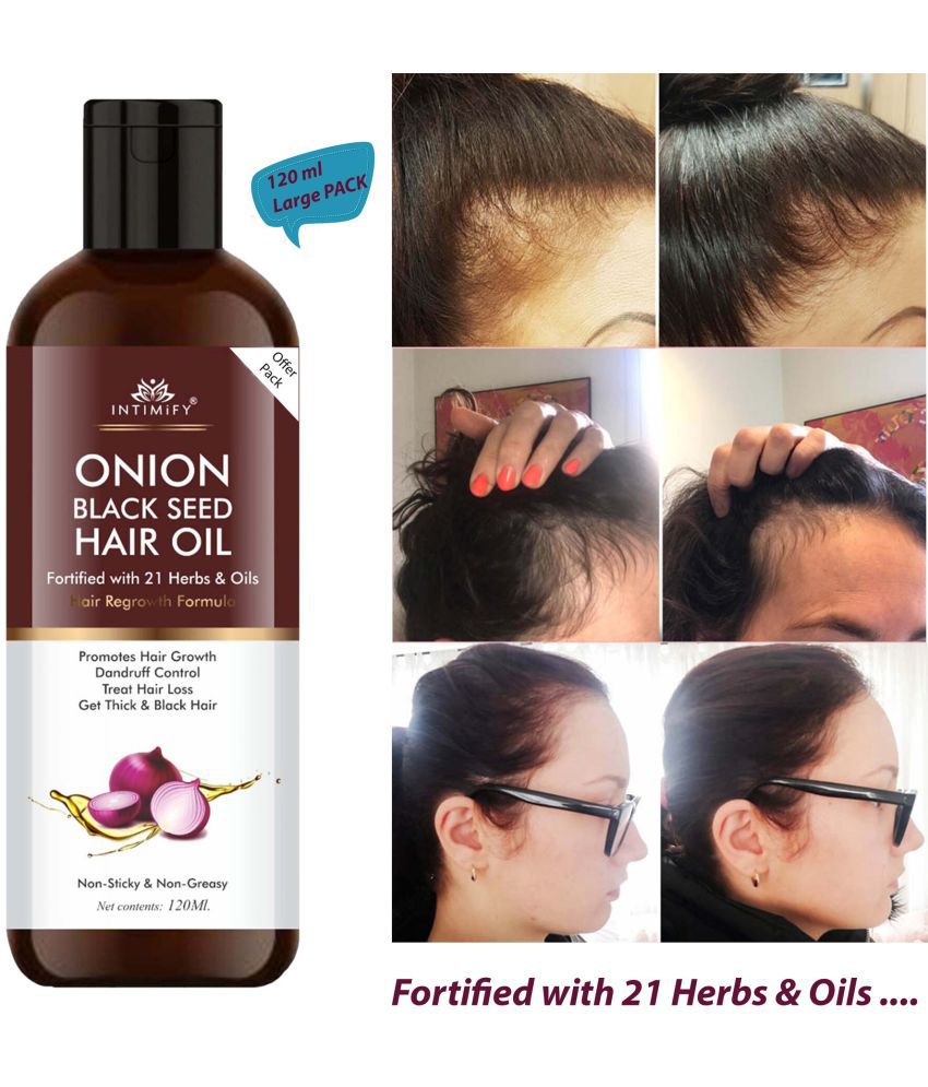 Intimify Onion Hair Oil for Hair Growth & Repair 120 mL: Buy Intimify Onion Hair  Oil for Hair Growth & Repair 120 mL at Best Prices in India - Snapdeal
