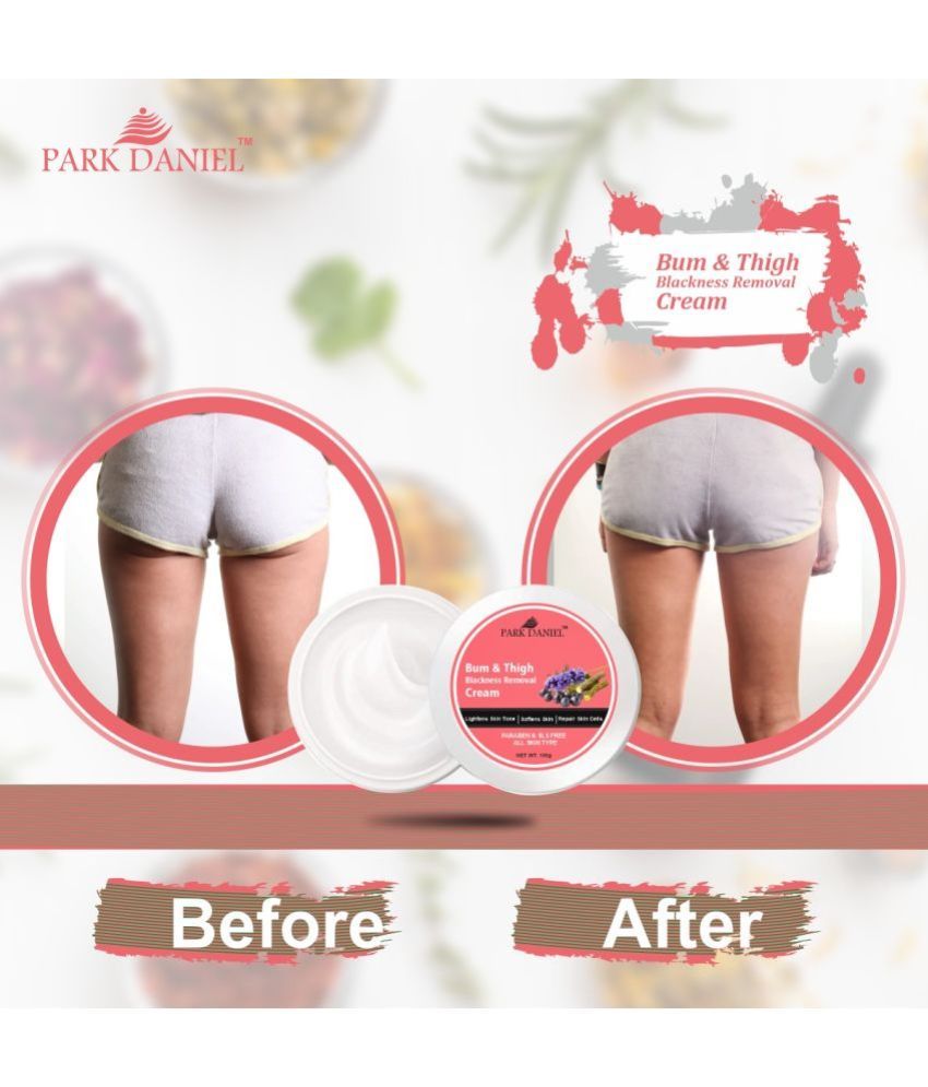     			Park Daniel Bum and Thigh Skin Lightening Cream to Remove Dark Patches Pack of 1 of 100 Grams