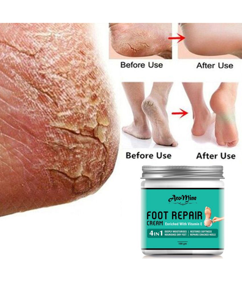 Aromine Cracked Heel Repair Specialist Cream Smooth Feet, Foot Cream ( 100 mL )