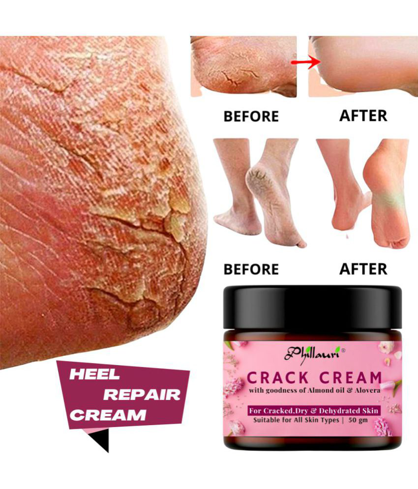     			Phillauri Foot Cracked Repair Cream For Healing & Soothing Of Cracked Heels ( 50gm)