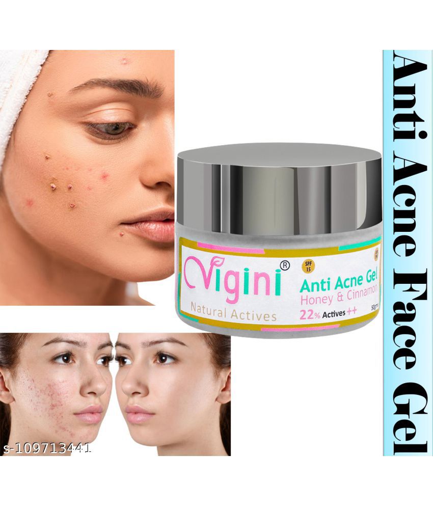 VIGINI ANTI ACNE FACE GEL FOR PIMPLES CONTROL SCARS REMOVAL WITH HONEY CINNAMON, NIACINAMIDE FACE SERUM SPF 15-50GM