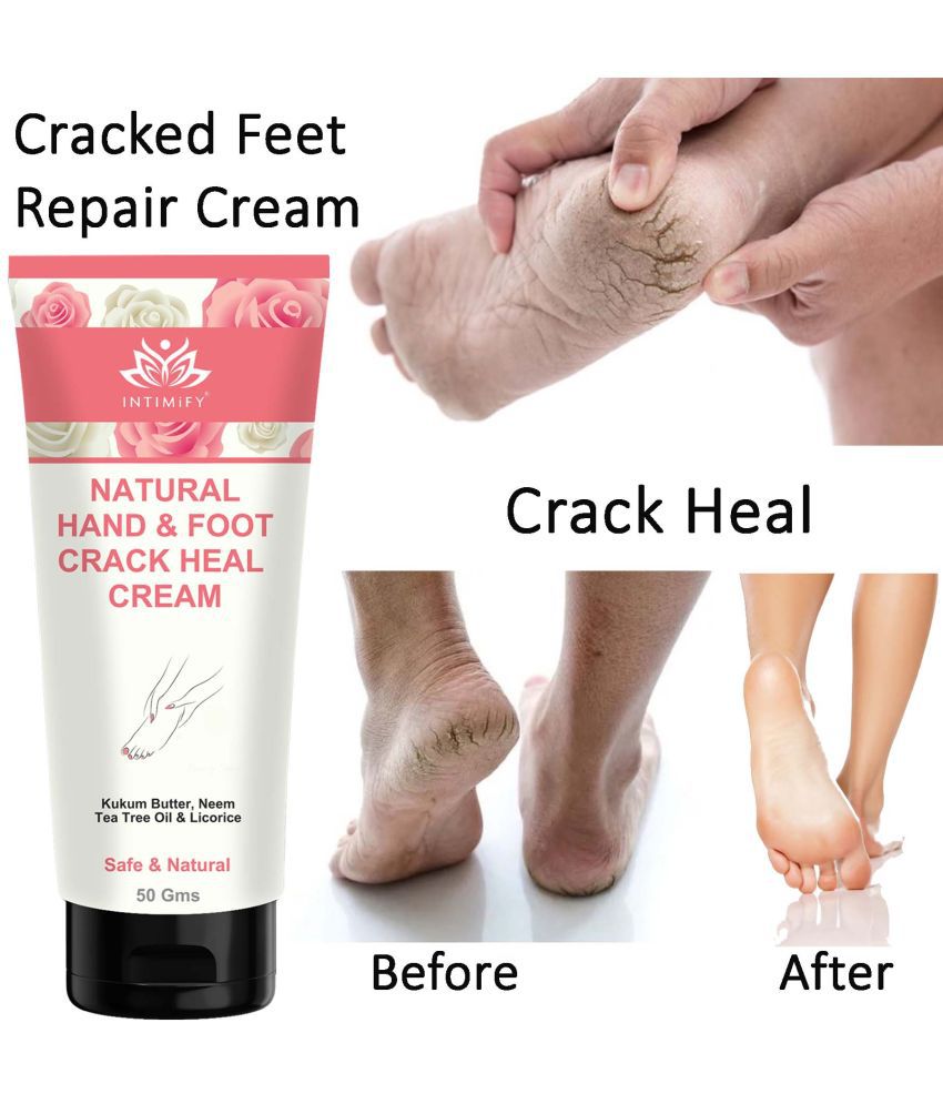Intimify Foot Crack Cream, Heel Crack Cream, Foot Care Foot Cream ( 50 g )