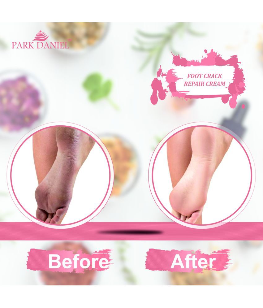     			Park Daniel Cracked Foot Repair Cream For Soft Heels Foot Cream SPF 5 ( 100 g )