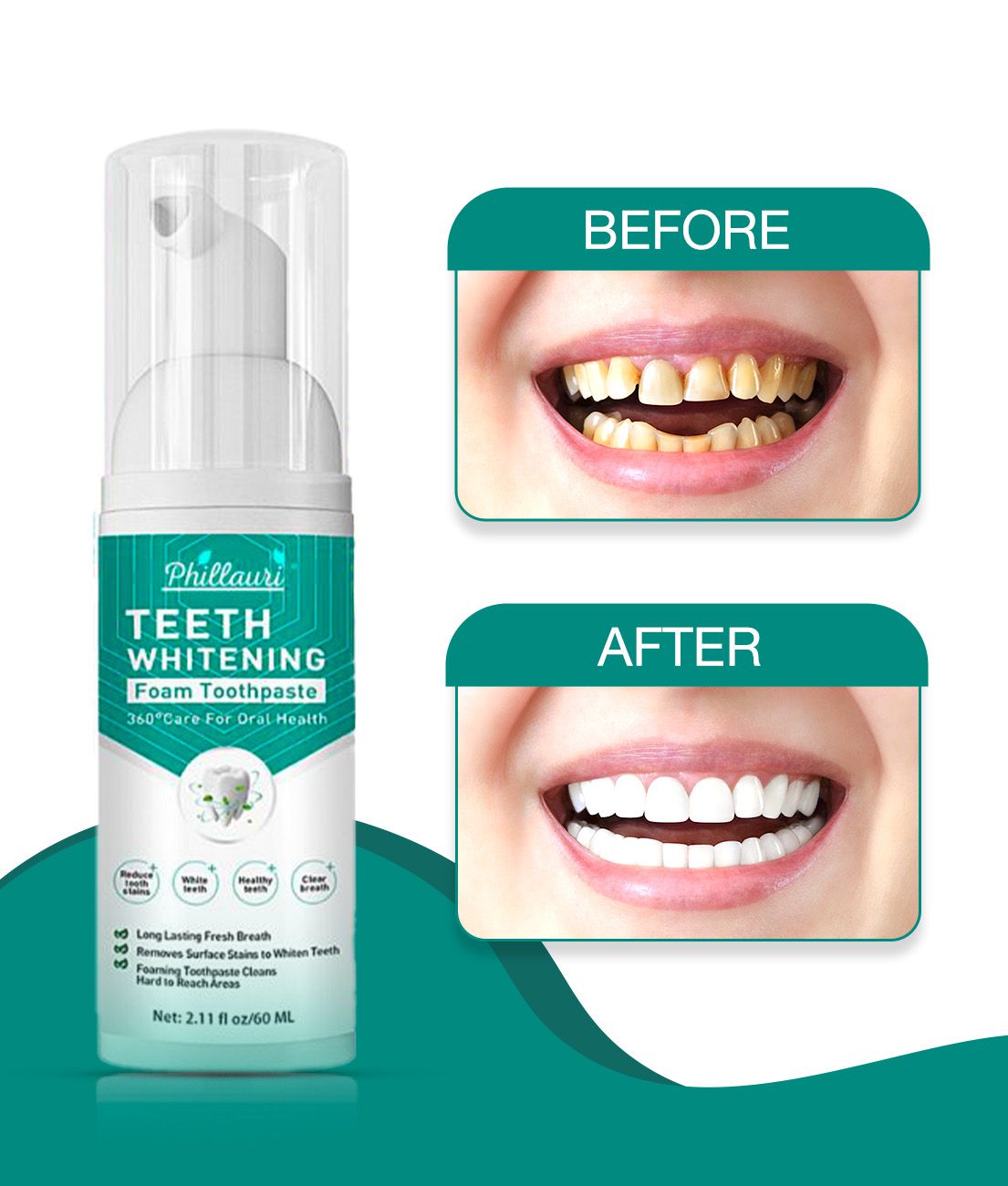     			Phillauri Teeth whitening fresh clean foam Denture Oral Kit