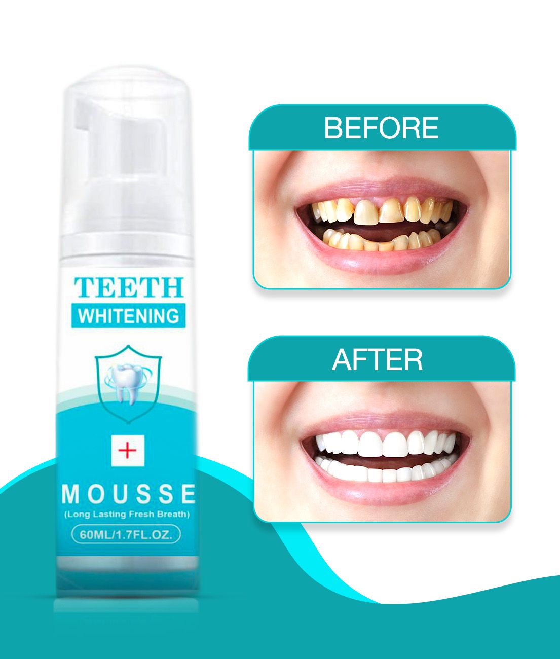     			Gantavya Advance Teeth Whitening,  Deep Cleanser Denture Oral Kit