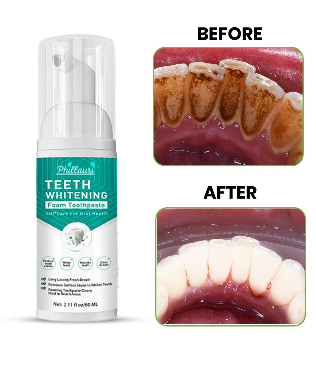     			Phillauri Deep Cleanser Teeth Foam Denture Oral Kit