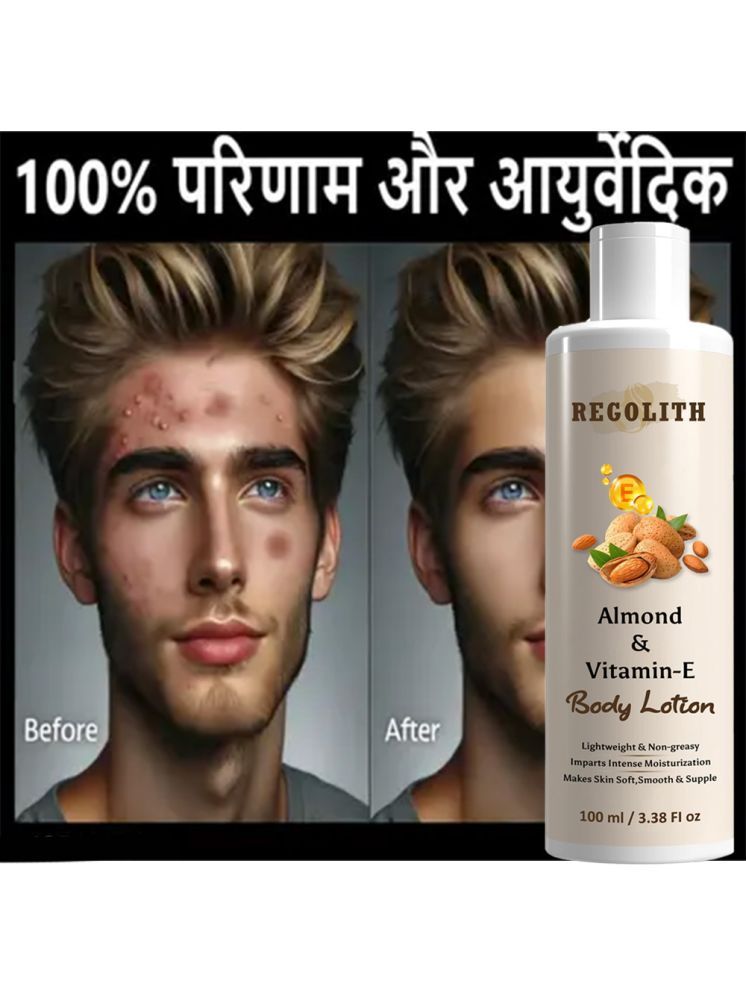     			REGOLITH Anti-Itch Lotion For Dry Skin 100 ml ( Pack of 1 )