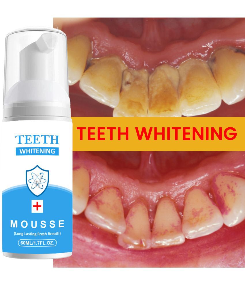     			Latibule Teeth Whitening Kit pure