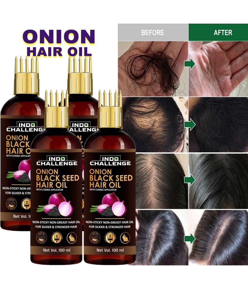     			INDO CHALLEGE Scalp Treatment Onion Oil 100 ml ( Pack of 4 )